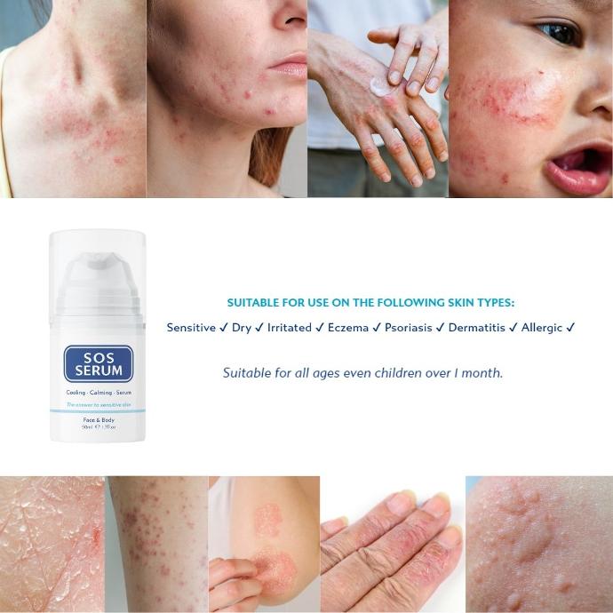 SOS Serum 15ML